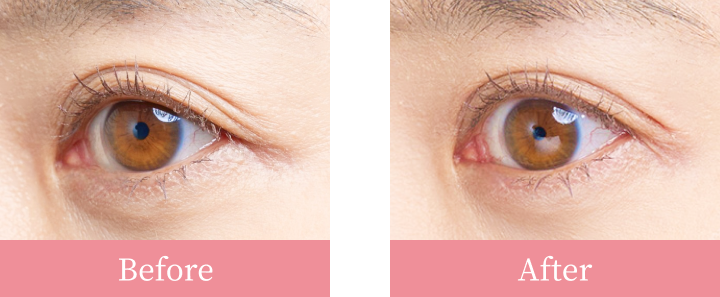 Before&After